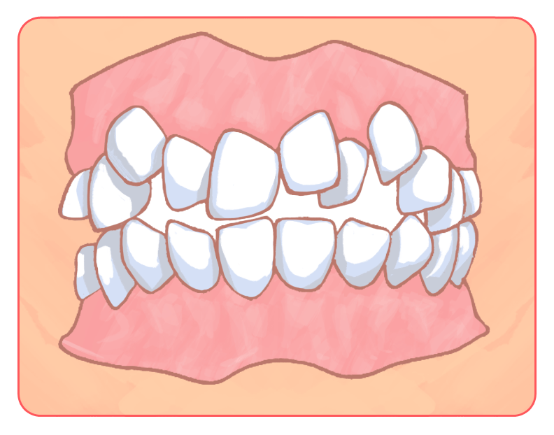 {{brizy_dc_image_alt imageSrc=