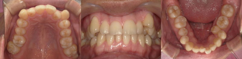 {{brizy_dc_image_alt imageSrc=