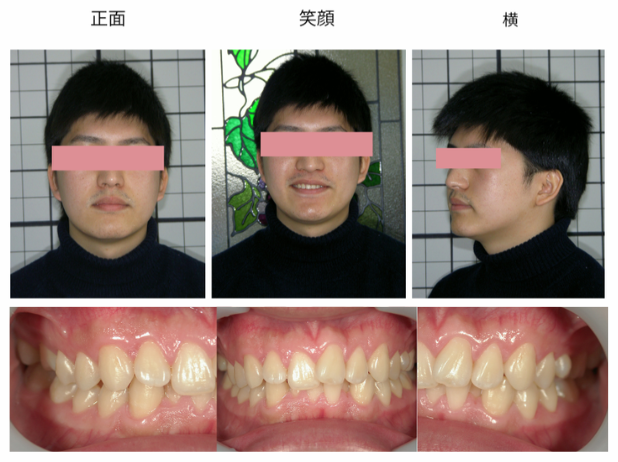 {{brizy_dc_image_alt imageSrc=