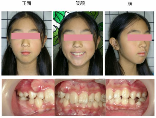 {{brizy_dc_image_alt imageSrc=